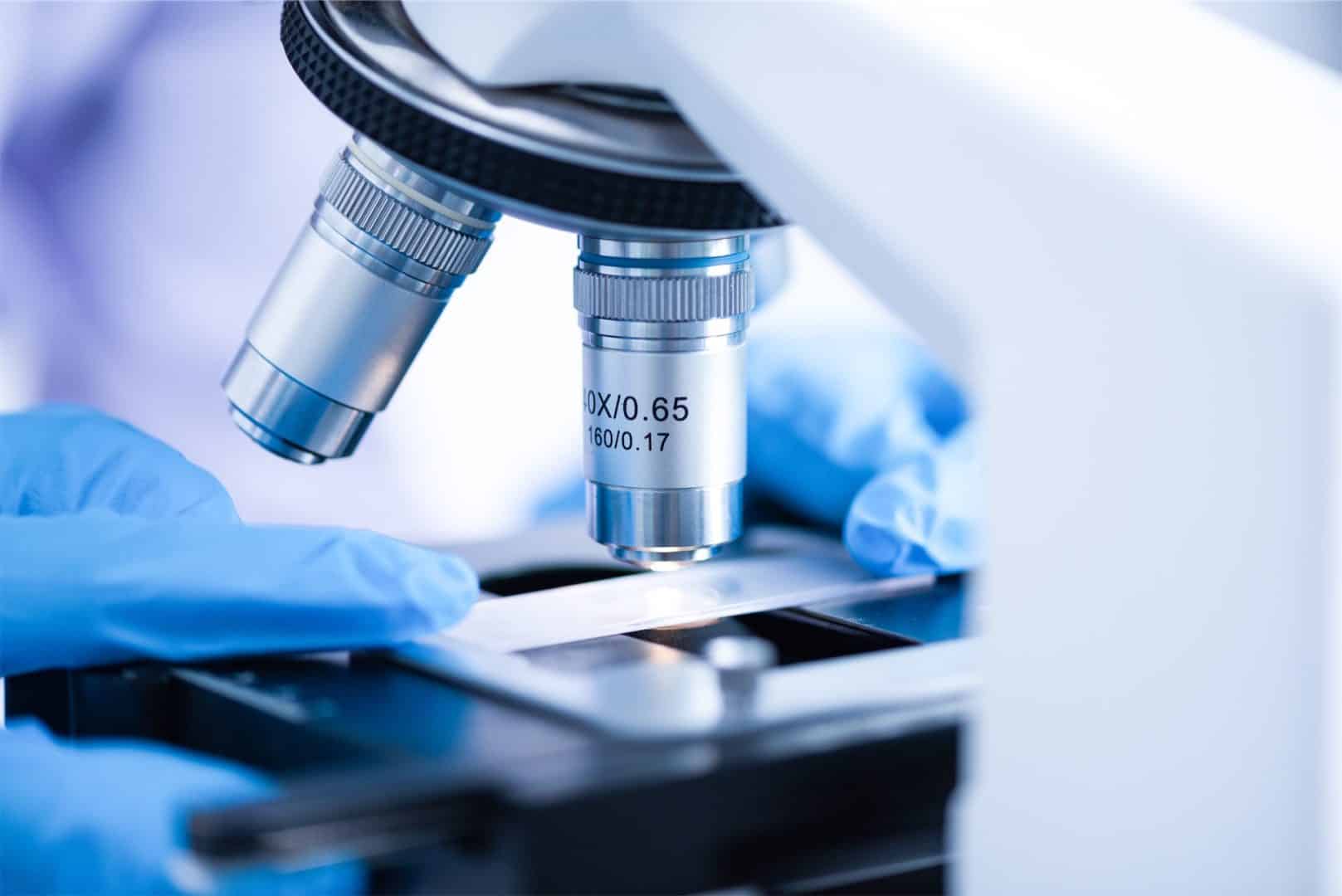Disbiosis Intestinal. Síntomas, causas y tratamientos para restaurar el equilibrio de tu microbiota 2 tratamientos para la disbiosis intestinal