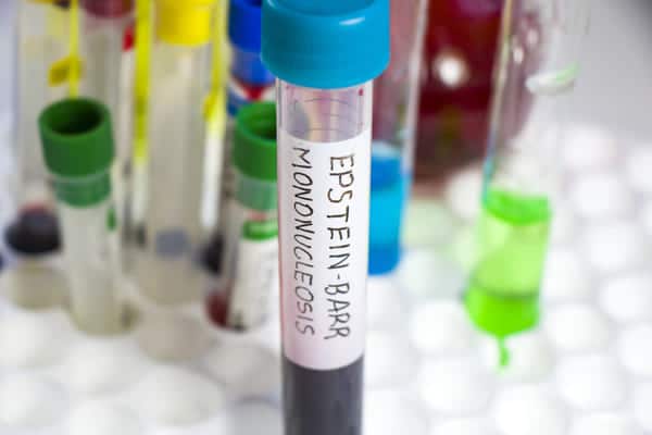 prueba de mononucleosis